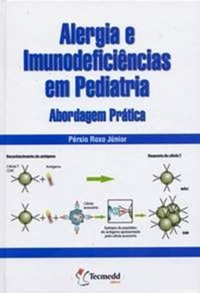 Picture of ALERGIA E IMUNODEFICIENCIAS EM PEDIATRIA