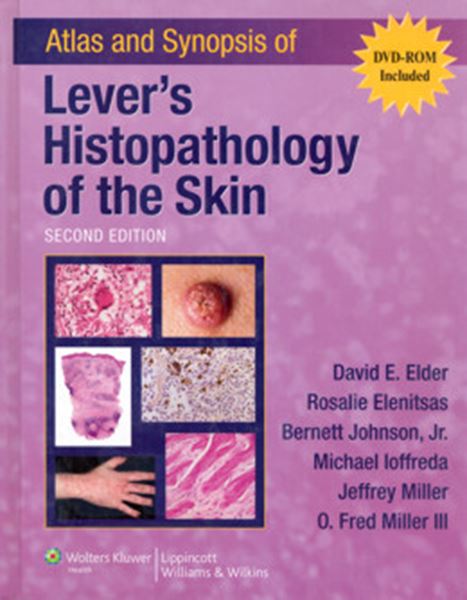 Picture of ATLAS AND SYNOPSIS OF LEVER´S HISTOPATHOLOGY OF THE SKIN - 2ND ED